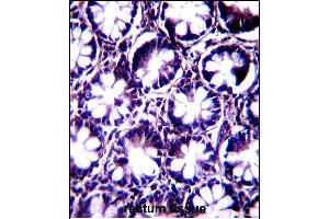 KI Antibody (C-term) (ABIN657603 and ABIN2846601) immunohistochemistry analysis in formalin fixed and paraffin embedded human rectum tissue followed by peroxidase conjugation of the secondary antibody and DAB staining. (KIAA1274 Antikörper  (C-Term))