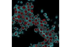 Immunofluorescence Analysis of RAW cells labeling KRT6 with KRT6 Mouse Monoclonal Antibody (SPM269) followed by Goat anti-Mouse IgG-CF488 (Cyan). (KRT6A/KRT6B/KRT6C (C-Term) Antikörper)