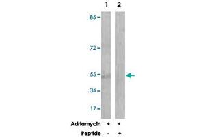 Western blot analysis of extracts from HUVEC cells, treated with Adriamycin (0. (Caspase 2 Antikörper  (Ser140))