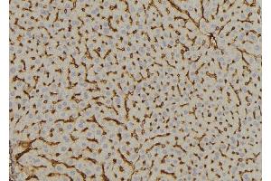 ABIN6269059 at 1/100 staining Mouse liver tissue by IHC-P. (DOK2 Antikörper  (Internal Region))