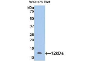 Western Blotting (WB) image for anti-Chemokine (C-X-C Motif) Ligand 1 (Melanoma Growth Stimulating Activity, Alpha) (CXCL1) (AA 25-96) antibody (ABIN1078404) (CXCL1 Antikörper  (AA 25-96))