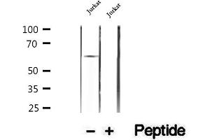 Western blot analysis of extracts of Jurkat cells, using HPSE antibody. (HPSE Antikörper  (Internal Region))