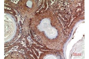 Immunohistochemistry (IHC) image for anti-Inhibin, beta B (INHBB) (C-Term) antibody (ABIN3187910)