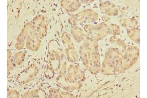 Immunohistochemistry of paraffin-embedded human pancreatic tissue using ABIN7149799 at dilution of 1:100 (DET1 Antikörper  (AA 15-240))