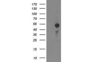 Western Blotting (WB) image for anti-Myocyte Enhancer Factor 2C (MEF2C) antibody (ABIN1499362) (MEF2C Antikörper)