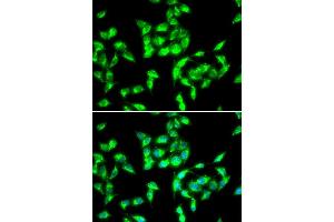Immunofluorescence analysis of HeLa cell using ANTXR1 antibody. (ANTXR1 Antikörper)