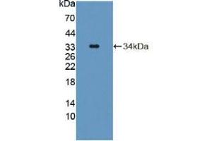 Figure. (TAT Antikörper  (AA 190-454))