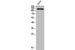 Western blot analysis of 293T using Acetyl-RIP140 (K158) antibody. (NRIP1 Antikörper  (acLys158))
