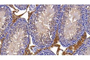 Immunohistochemistry (IHC) image for anti-Fatty Acid Binding Protein 3, Muscle and Heart (FABP3) (AA 1-133) antibody (ABIN7433315)