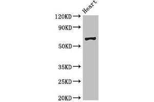 Western Blot Positive WB detected in: Mouse heart tissue All lanes: PES1 antibody at 3 μg/mL Secondary Goat polyclonal to rabbit IgG at 1/50000 dilution Predicted band size: 69, 68 kDa Observed band size: 69 kDa (PES1 Antikörper  (AA 378-588))