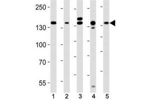 Western blot analysis of lysate from (1) HeLa, (2) MCF-7, (3) mouse C2C12, (4) mouse NIH3T3, (5) rat C6 cell line using Raptor antibody at 1:1000. (RAPTOR Antikörper)