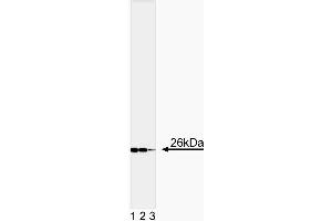 Western blot analysis of Bcl-2 (Second Panel). (Bcl-2 Antikörper  (AA 41-54))