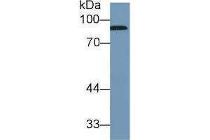 Western Blot; Sample: Human Serum; Primary Ab: 1µg/ml Rabbit Anti-Human CFB Antibody Second Ab: 0. (Complement Factor B Antikörper  (AA 477-600))