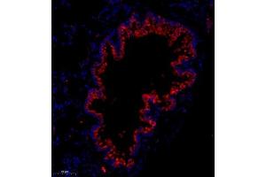 Immunofluorescence analysis of paraffin embedded mouse lung using Flt4 (ABIN7076194) at dilution of 1: 400 (Vegf Receptor 3 Antikörper)