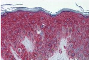Human Skin: Formalin-Fixed, Paraffin-Embedded (FFPE) (Peroxiredoxin 6 Antikörper  (C-Term))