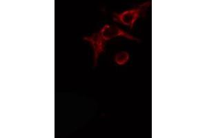 ABIN6274490 staining Hela cells by IF/ICC. (ADPGK Antikörper  (Internal Region))
