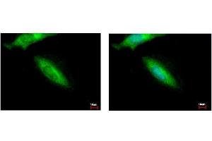 ICC/IF Image HIP55 antibody [N1], N-term detects DBNL protein at cytoplasm by immunofluorescent analysis. (DBNL Antikörper  (N-Term))
