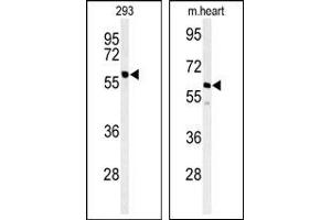 Image no. 1 for anti-Protein Phosphatase, Mg2+/Mn2+ Dependent, 1G (PPM1G) (Middle Region) antibody (ABIN360762)