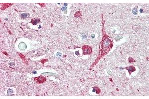 Detection of DDR2 in Human Cerebrum Tissue using Polyclonal Antibody to Discoidin Domain Containing Receptor 2 (DDR2) (DDR2 Antikörper  (AA 578-817))