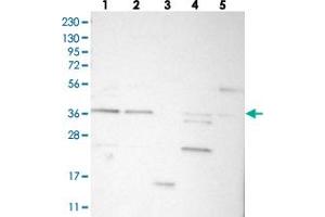 Western blot analysis of Lane 1: RT-4, Lane 2: U-251 MG, Lane 3: Human Plasma, Lane 4: Liver, Lane 5: Tonsil with C17orf81 polyclonal antibody  at 1:250-1:500 dilution. (Retinoic Acid Induced 12 (RAI12) Antikörper)