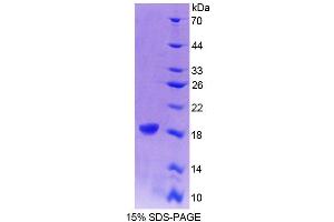 SDS-PAGE (SDS) image for Cellular Retinoic Acid Binding Protein 1 (CRABP1) (AA 2-137) protein (His tag) (ABIN6239083) (CRABP1 Protein (AA 2-137) (His tag))