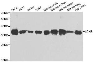 Western blot analysis of extracts of various cell lines, using LDHB antibody. (LDHB Antikörper)