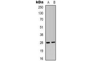 Western blot analysis of IGFBP1 expression in HepG2 (A), MCF7 (B) whole cell lysates. (IGFBPI Antikörper)