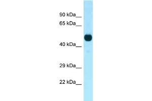 WB Suggested Anti-Cdk14 Antibody Titration: 1. (CDK14 Antikörper  (C-Term))