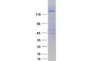 Western Blotting (WB) image for ATP-Binding Cassette, Sub-Family C (CFTR/MRP), Member 8 (ABCC8) protein (Myc-DYKDDDDK Tag) (ABIN2714263)