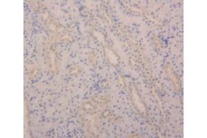 IHC-P analysis of Rat Kidney Tissue, with DAB staining. (Angiopoietin 2 Antikörper  (AA 33-243))