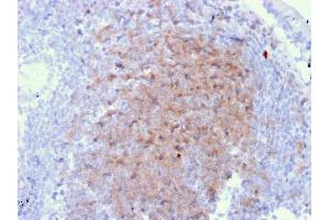 Formalin-fixed, paraffin-embedded human Lymph Node in Colon stained with CD72 Mouse Monoclonal Antibody (BU40). (CD72 Antikörper)