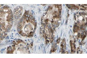 ABIN6277764 at 1/100 staining Human prostate tissue by IHC-P. (Golgin A2 (GOLGA2) (N-Term) Antikörper)