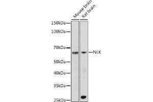 Western blot analysis of extracts of various cell lines, using NLK antibody (ABIN7268846) at 1:500 dilution. (Nemo-Like Kinase Antikörper)