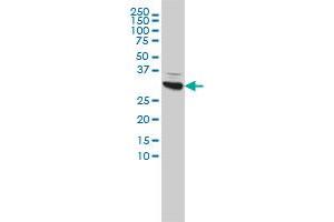 CBR1 monoclonal antibody (M02), clone 4D12-1G8 Western Blot analysis of CBR1 expression in Hela . (CBR1 Antikörper  (AA 1-277))