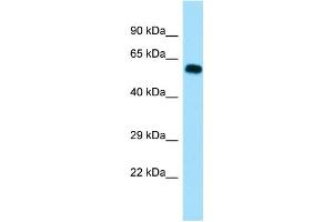 WB Suggested Anti-SGOL1 Antibody Titration: 1. (Shugoshin Antikörper  (C-Term))