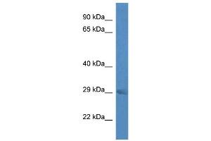 WB Suggested Anti-Rab23 Antibody Titration: 1. (RAB23 Antikörper  (Middle Region))