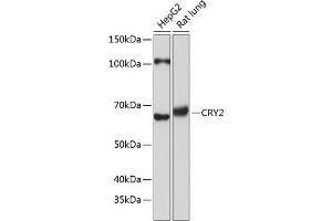 Western blot analysis of extracts of various cell lines, using CRY2 Polyclonal Antibody (ABIN7266526) at 1:1000 dilution. (CRY2 Antikörper  (AA 36-266))