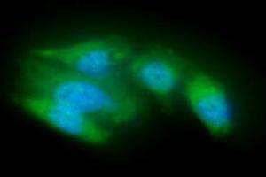 ICC/IF analysis of ACOT8 in A549 cells line, stained with DAPI (Blue) for nucleus staining and monoclonal anti-human ACOT8 antibody (1:100) with goat anti-mouse IgG-Alexa fluor 488 conjugate (Green). (ACOT8 Antikörper  (AA 1-319))
