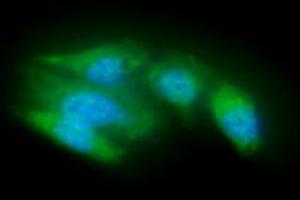 ICC/IF analysis of ACOT8 in A549 cells line, stained with DAPI (Blue) for nucleus staining and monoclonal anti-human ACOT8 antibody (1:100) with goat anti-mouse IgG-Alexa fluor 488 conjugate (Green). (ACOT8 Antikörper)
