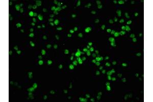 Immunofluorescence staining of K562 cells with ABIN7127740 at 1:100,counter-stained with DAPI. (Rekombinanter Retinoblastoma 1 Antikörper  (pSer780))