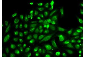 Immunofluorescence analysis of HeLa cells using SPHK1 antibody. (SPHK1 Antikörper)