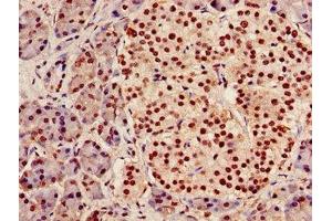 Immunohistochemistry of paraffin-embedded human pancreatic tissue using ABIN7142023 at dilution of 1:100 (AGPAT5 Antikörper  (AA 174-313))