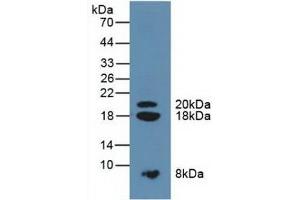 Detection of SPINK1 in Mouse Pancreas Tissue using Polyclonal Antibody to Serine Peptidase Inhibitor Kazal Type 1 (SPINK1) (SPINK1 Antikörper  (AA 26-78))
