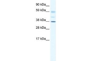 WB Suggested Anti-SOX17 Antibody Titration: 0. (SOX17 Antikörper  (C-Term))