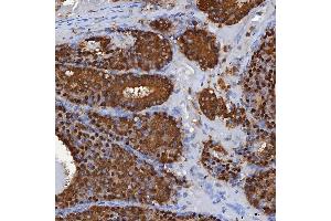 IHC analysis of SBP/SELENBP1 using anti-SBP/SELENBP1 antibody (ABIN7600755). (SELENBP1 Antikörper  (AA 23-462))