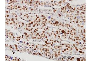 Image no. 4 for anti-serine/threonine Kinase 38 (STK38) (AA 1-466) antibody (ABIN599179) (STK38 Antikörper  (AA 1-466))