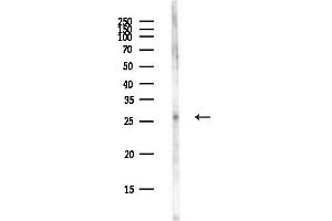 Western blot analysis of lysates from EC304 cells(LPS,4h treatment), using TP53RK Antibody at 1/1000 dilution.