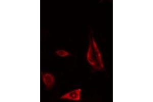 Immunofluorescence (fixed cells) (IF/ICC) image for anti-Tumor Necrosis Factor, alpha-Induced Protein 3 (TNFAIP3) (Internal Region) antibody (ABIN6265632)