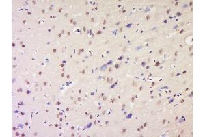 Formalin-fixed and paraffin embedded rat brain labeled with Anti-NSD1 Polyclonal Antibody, Unconjugated  at 1:200 followed by conjugation to the secondary antibody and DAB staining.