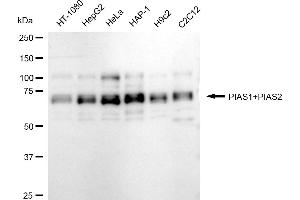 anti-E3 SUMO-Protein Ligase PIAS3 (LOC101740849) antibody